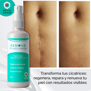 RENOVA SPRAY CICATRIZANTE