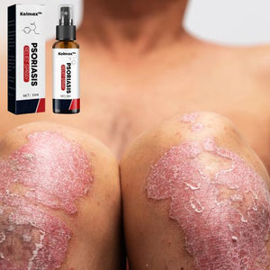 KOLMAX™  SPRAY PARA TRATAMIENTO DE PSORIASIS