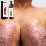 KOLMAX™  SPRAY PARA TRATAMIENTO DE PSORIASIS