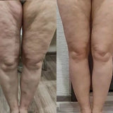 ALTUS CREMA ANTICELULITIS