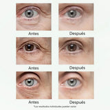 CELYN Crema reafirmante para zona de los ojos, eliminación de arrugas y ojeras