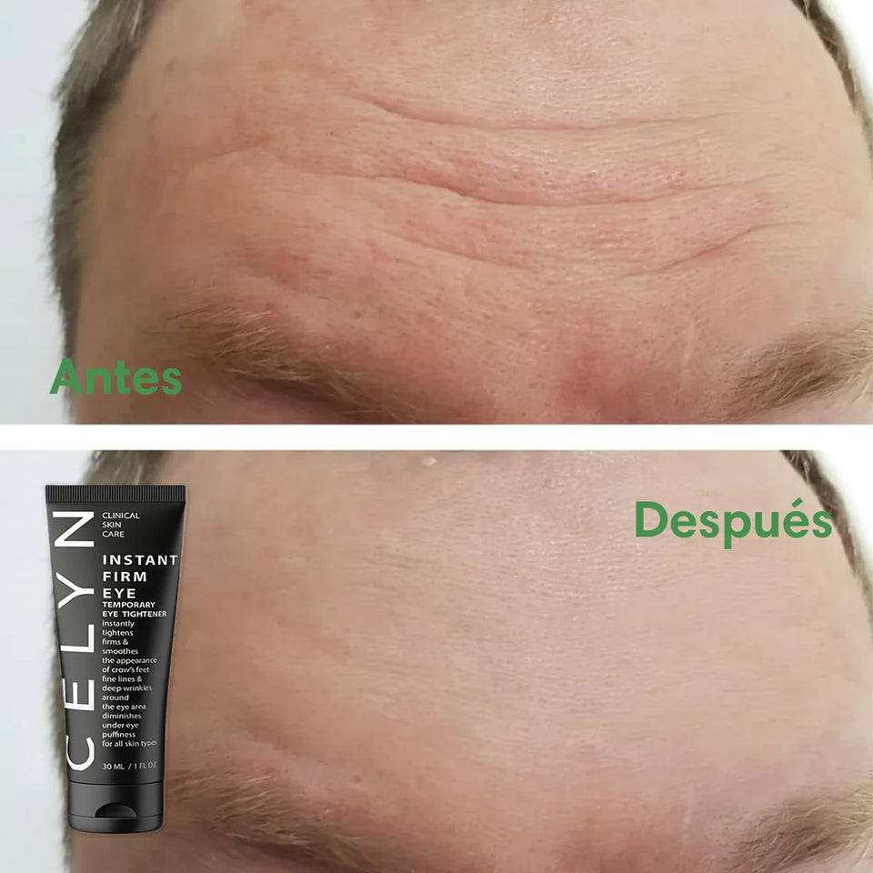 CELYN Crema reafirmante para zona de los ojos, eliminación de arrugas y ojeras