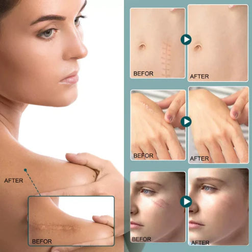 RENOVA SPRAY CICATRIZANTE