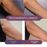 ALTUS CREMA ANTICELULITIS